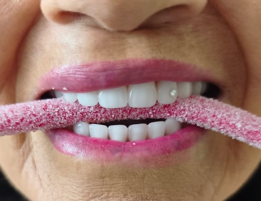 Estética dental