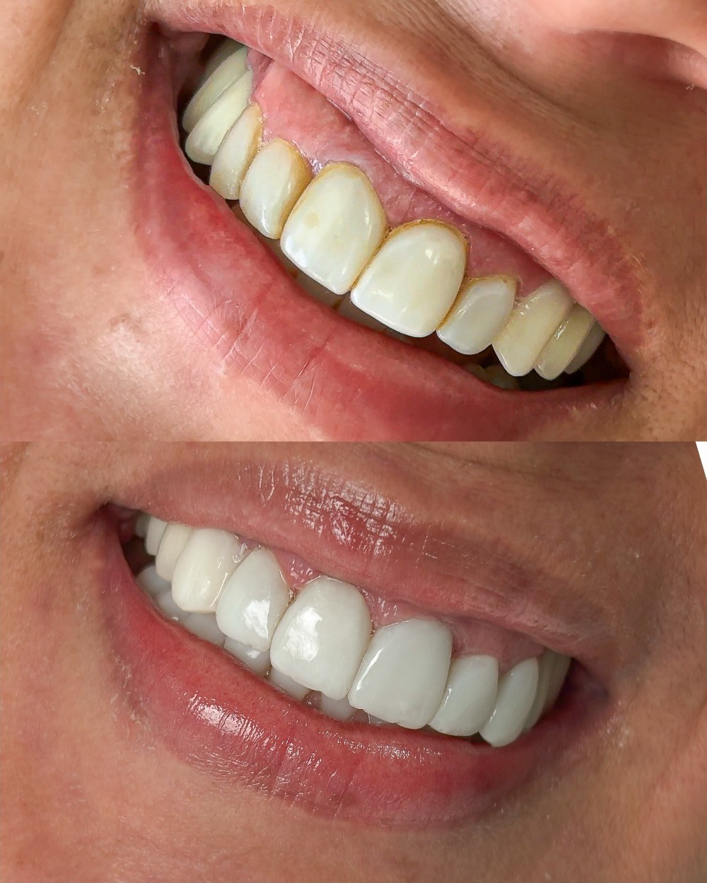 Estética dental
